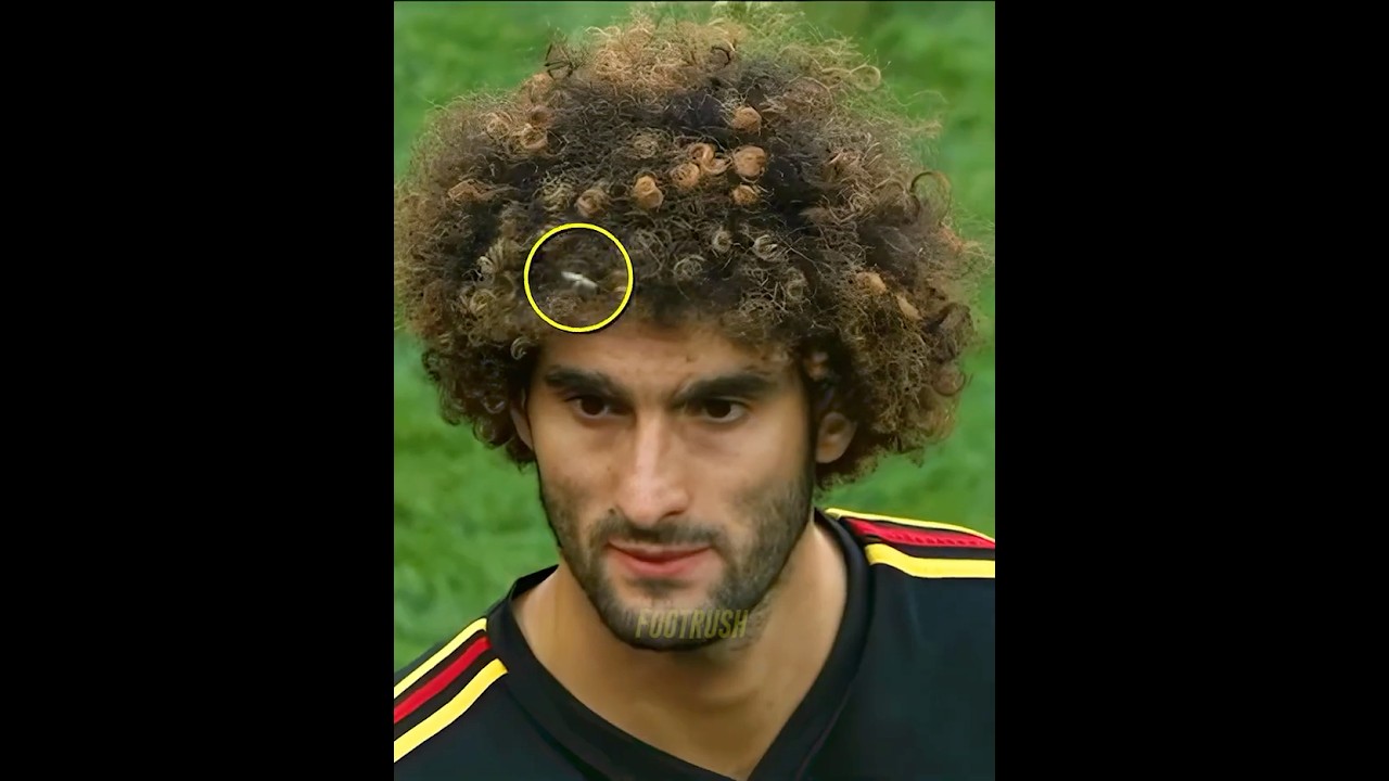 Players vs Insects + BALLKID